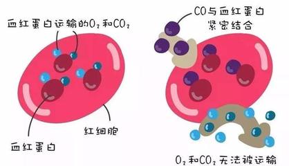 警惕洗澡季隱形殺手 一氧化碳中毒康復后，當心遲發性腦病